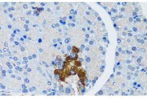 Immunohistochemistry of paraffin-embedded Rat pancreatic islet using TSC1 Polyclonal Antibody at dilution of 1:200 (40x lens). (TSC1 Antikörper)