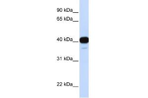 WB Suggested Anti-FOXL1 Antibody Titration: 0. (FOXL1 Antikörper  (Middle Region))