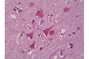 Anti-EPHX2 antibody IHC of human brain, cortex neurons. (EPHX2 Antikörper)