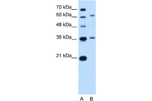 WB Suggested Anti-ZSCAN12 Antibody Titration:  5. (ZSCAN12 Antikörper  (N-Term))