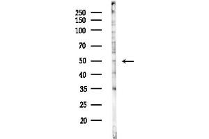 Western blot analysis of lysates from HUVEC cells(starvation,24h treatment), using TFAP2D Antibody at 1/1000 dilution.