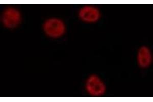 ABIN6275887 staining HepG2 by IF/ICC. (LHX1 Antikörper  (Internal Region))