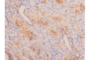 Figure. (TPSAB1 Antikörper  (AA 161-262))