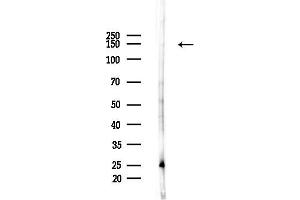 anti-Centromere Protein J (CENPJ) (C-Term) antibody