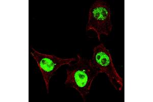 Fluorescent confocal ige of HeLa cells stained with phospho-SD3- antibody. (SMAD3 Antikörper  (pSer208))