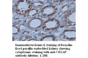 Image no. 1 for anti-CD2-Associated Protein (Cd2ap) (C-Term) antibody (ABIN791046) (CD2AP Antikörper  (C-Term))