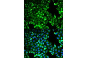 Immunofluorescence analysis of U2OS cell using PDLIM5 antibody. (PDLIM5 Antikörper)