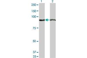 Western Blot analysis of AMPD2 expression in transfected 293T cell line by AMPD2 monoclonal antibody (M04), clone 2G8. (AMPD2 Antikörper  (AA 86-185))