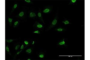 Immunofluorescence of purified MaxPab antibody to HMGA1 on HeLa cell.