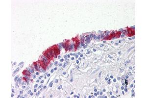 Anti-ARVCF antibody IHC of human lung, respiratory epithelium. (ARVCF Antikörper  (AA 863-963))