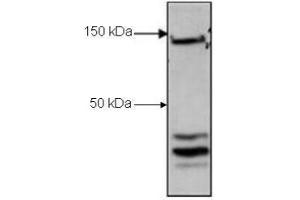 Western Blot of Rabbit Anti-CTCF antibody. (CTCF Antikörper  (C-Term))