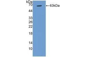 Detection of Recombinant CCND1, Human using Polyclonal Antibody to Cyclin D1 (CCND1)