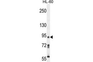 Western Blotting (WB) image for anti-KRI1 Homolog (KRI1) antibody (ABIN5015220) (KRI1 Antikörper)