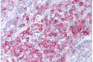 Human Tonsil (formalin-fixed, paraffin-embedded) stained with C1QTNF4 antibody ABIN213915 at 5 ug/ml followed by biotinylated goat anti-rabbit IgG secondary antibody ABIN481713, alkaline phosphatase-streptavidin and chromogen. (C1QTNF4 Antikörper  (C-Term))