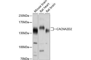 Western blot analysis of extracts of various cell lines, using CD2 antibody (ABIN6130178, ABIN6137811, ABIN6137812 and ABIN6214454) at 1:1000 dilution. (CACNA2D2 Antikörper  (AA 20-200))