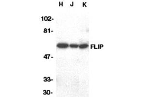 Western Blotting (WB) image for anti-CASP8 and FADD-Like Apoptosis Regulator (CFLAR) (C-Term) antibody (ABIN1030398)