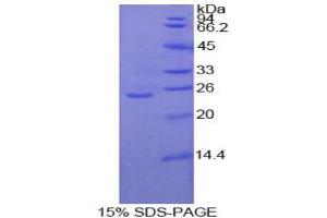 SDS-PAGE analysis of Human Protein Kinase C zeta Protein. (PKC zeta Protein)