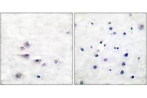 Immunohistochemistry analysis of paraffin-embedded human brain, using Shc (Phospho-Tyr427) Antibody. (SHC1 Antikörper  (pTyr427))