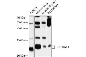 Western blot analysis of extracts of various cell lines, using S100 antibody (ABIN6128693, ABIN6147339, ABIN6147340 and ABIN6214636) at 1:1000 dilution. (S100A14 Antikörper  (AA 1-104))
