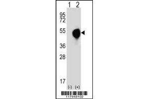 Western blot analysis of DOM3Z using rabbit polyclonal DOM3Z Antibody (N-term Y88) using 293 cell lysates (2 ug/lane) either nontransfected (Lane 1) or transiently transfected (Lane 2) with the DOM3Z gene. (DOM3Z Antikörper  (N-Term))