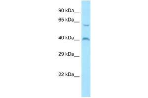 Host: Rabbit Target Name: MORN1 Sample Type: ACHN Whole Cell lysates Antibody Dilution: 1. (MORN1 Antikörper  (C-Term))