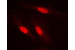 Immunofluorescent analysis of SMAD2 staining in Jurkat cells.