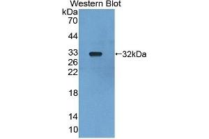 Detection of Recombinant LRDD, Mouse using Polyclonal Antibody to Leucine Rich Repeats And Death Domain Containing Protein (LRDD) (Leucine Rich Repeats And Death Domain Containing Protein (AA 666-915) Antikörper)