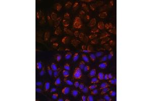 Immunofluorescence analysis of U-2 OS cells using  antibody (ABIN6129884, ABIN6137152, ABIN6137153 and ABIN6214229) at dilution of 1:100. (ART1 Antikörper  (AA 23-295))