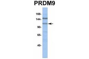 Western Blotting (WB) image for anti-PR Domain Containing 9 (PRDM9) (Middle Region) antibody (ABIN2774963)