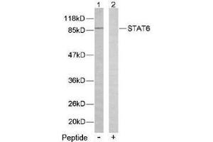 Image no. 2 for anti-Signal Transducer and Activator of Transcription 6, Interleukin-4 Induced (STAT6) (Thr645) antibody (ABIN197187) (STAT6 Antikörper  (Thr645))