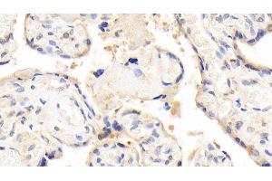 Immunohistochemistry (IHC) image for anti-Leptin (LEP) (AA 22-167) antibody (ABIN7445093)