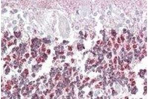 Immunohistochemistry (IHC) image for anti-Epilepsy, Progressive Myoclonus Type 2A, Lafora Disease (Laforin) (EPM2A) (Internal Region) antibody (ABIN2466629) (EPM2A Antikörper  (Internal Region))