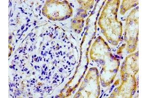 Immunohistochemistry (IHC) image for anti-Prostaglandin Reductase 2 (PTGR2) (AA 206-282) antibody (ABIN7164870)