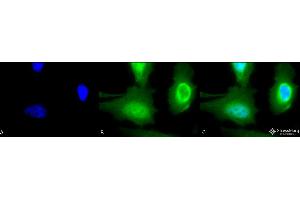 Immunocytochemistry/Immunofluorescence analysis using Rabbit Anti-Calreticulin Polyclonal Antibody . (Calreticulin Antikörper  (Atto 488))