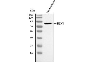 Western blot analysis of RIN1 using anti-RIN1 antibody (ABIN7602432).