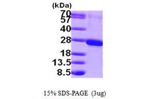 SDS-PAGE (SDS) image for RAB1B, Member RAS Oncogene Family (RAB1B) (AA 1-201) protein (His tag) (ABIN667849)