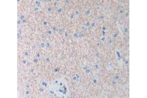 Used in DAB staining on fromalin fixed paraffin- embedded Kidney tissue (AIP Antikörper  (AA 63-296))