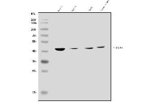 Western blot analysis of KCNJ16 using anti-KCNJ16 antibody (ABIN7599369).