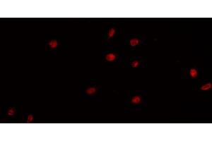 ABIN6266854 staining K-562 cells by IF/ICC. (PRKDC Antikörper  (Internal Region))