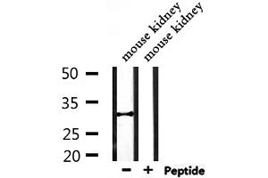 Western blot analysis of extracts from mouse kidney, using CBR1 Antibody.