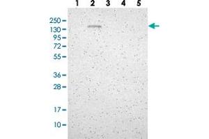 Western blot analysis of Lane 1: RT-4, Lane 2: U-251 MG, Lane 3: Human Plasma, Lane 4: Liver, Lane 5: Tonsil with GLG1 polyclonal antibody  at 1:250-1:500 dilution.