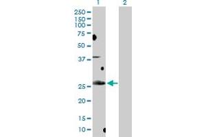 Western Blot analysis of BCL7B expression in transfected 293T cell line by BCL7B MaxPab polyclonal antibody. (BCL7B Antikörper  (AA 1-202))