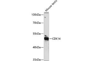 Western blot analysis of extracts of mouse testis, using CDK14 antibody (ABIN7266579) at 1:1000 dilution. (CDK14 Antikörper  (AA 312-451))