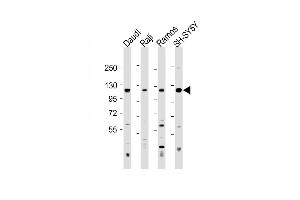 Western Blotting (WB) image for anti-Leukocyte Immunoglobulin-Like Receptor, Subfamily B (With TM and ITIM Domains), Member 1 (LILRB1) (AA 345-374) antibody (ABIN1538335)