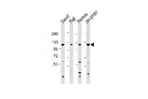 All lanes : Anti-LILRB1 Antibody (Center) at 1:500-1:2000 dilution Lane 1: Daudi whole cell lysate Lane 2: Raji whole cell lysate Lane 3: Ramos whole cell lysate Lane 4: SH-SY5Y whole cell lysate Lysates/proteins at 20 μg per lane. (LILRB1 Antikörper  (AA 345-374))