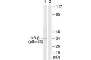 Western blot analysis of extracts from HeLa cells treated with TNF-a 20ng/ml 5', using IkappaB-beta (Phospho-Ser23) Antibody. (NFKBIB Antikörper  (pSer23))