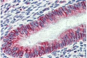 Immunohistochemistry (Formalin-fixed Paraffin-embedded Sections) (IHC (fp)) image for anti-Phosphatase and Actin Regulator 1 (PHACTR1) (AA 468-517) antibody (ABIN6744441)