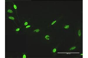 Immunofluorescence of purified MaxPab antibody to ZNF530 on HeLa cell. (ZNF530 Antikörper  (AA 1-599))