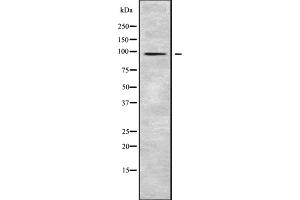 Western blot analysis SLC39A10 using HepG2 whole cell lysates (SLC39A10 Antikörper  (Internal Region))