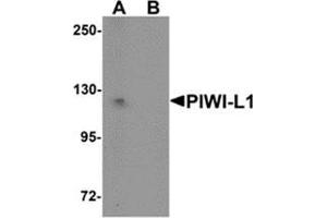 Western blot analysis of PIWI-L1 in HepG2 cell lysate with PIWI-L1 antibody at 1 μg/ml in (A) the absence and (B) the presence of blocking peptide. (PIWIL1 Antikörper  (N-Term))